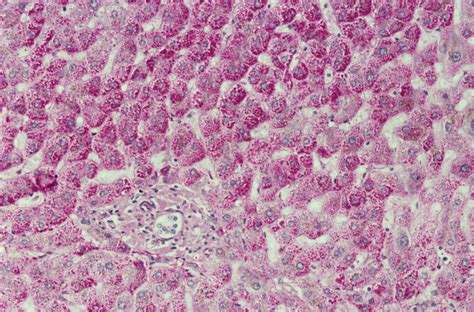 Liver Cells Light Micrograph Stock Image P5300185