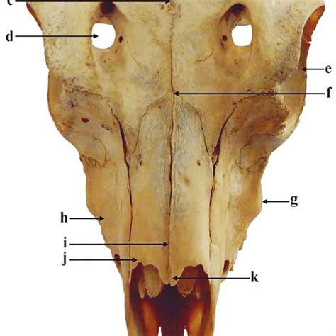Nuchal View Of Skull Showing Occipital Condyle A Foramen Magnum B