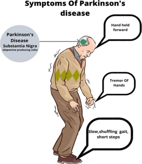 Symptoms Of Parkinsons Disease Download Scientific Diagram