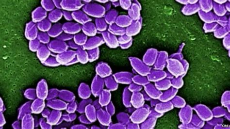 Live Anthrax Shipped Accidentally To S Korea And Us Labs Bbc News