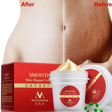 Stretch Marks Removal Cream Skin Repair Body Cream Natural Essence