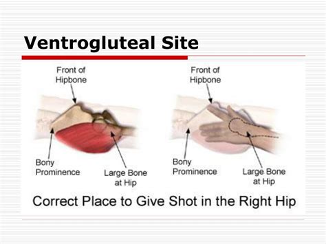 Ppt Intramuscular Injection Powerpoint Presentation Free Download Id 1452695