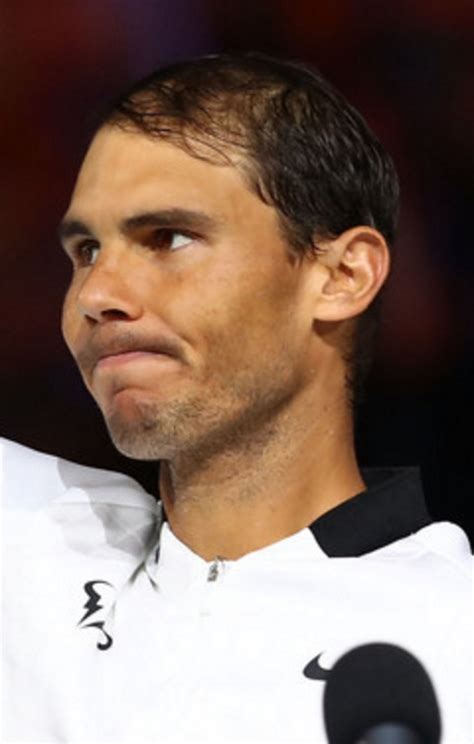 Rafa Nadal Hair Loss Pictures with Baldness Explanation Too