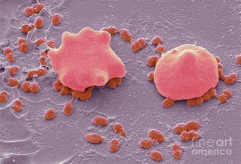 Streptococcus Pneumoniae Photograph By Steve Gschmeissnerscience Photo