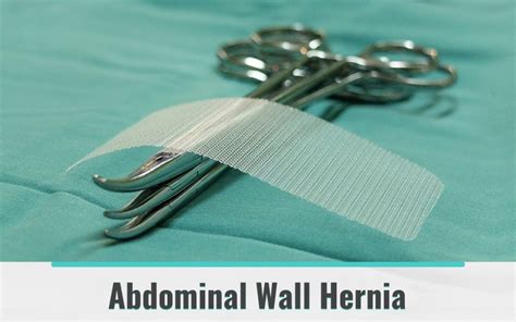 Abdominal Wall Hernia Dr Shwetal Dighe