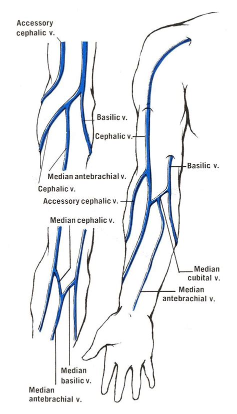 Some Common Patterns Of The Superficial Veins Of The Upper Limb Only