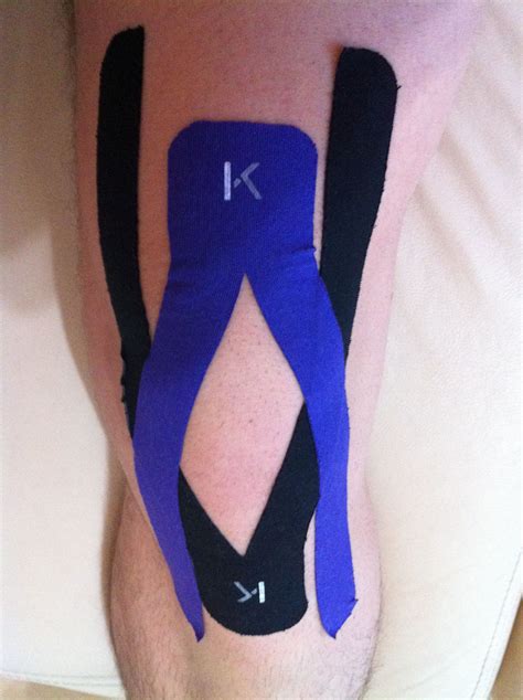 How To Kt Tape Knee For Torn Medial Meniscus