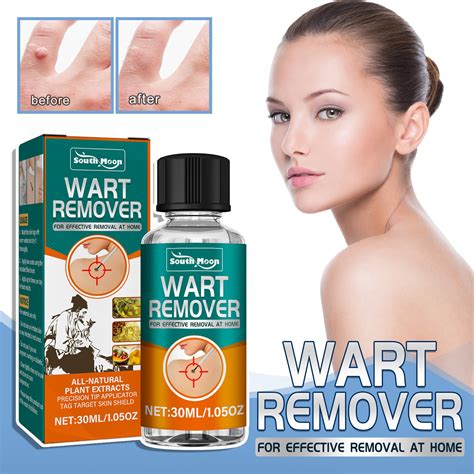 Duaonets Wart Remover Set Rapidly Eliminates Plantar And Common Warts Papillomas Skin Tags