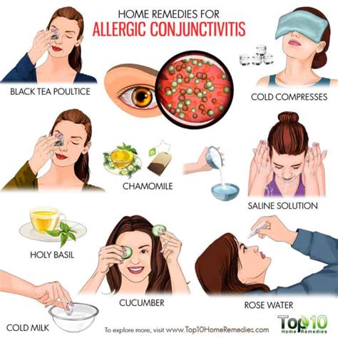 Home Remedies For Allergic Conjunctivitis Top 10 Home Remedies