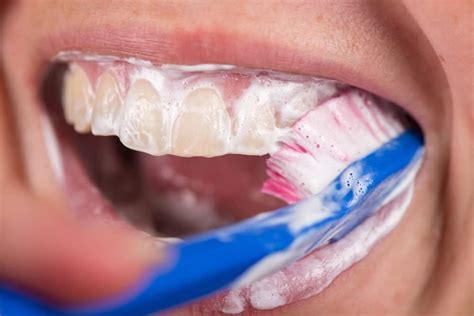Many People Make These Mistakes While Brushing Their Teeth