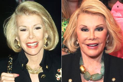 Is Joan Rivers Plastic Surgery Gone Wrong Jessica Parker