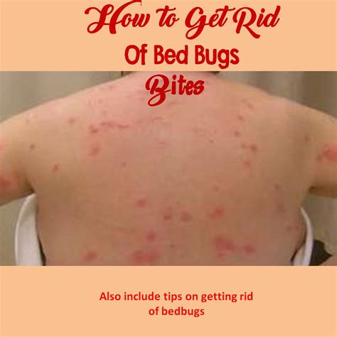 What Are Bed Bugs Bed Bug Bites Treatment Diy Bed Bug
