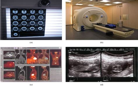Innovative Medical Image Processing Projects Using Matlab