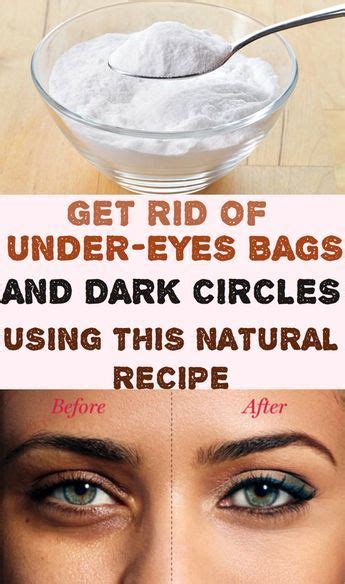 Get Rid Of Under Eyes Bags And Dark Circles Using This Natural Recipe Under Eye Bags Undereye