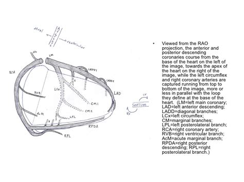 The left coronary artery displays variations in pattern, number and distribution of its branches. Heldman Coronary Anatomy Diagrams