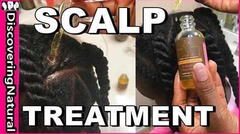 Scalp Treatment For Hair Growth Youtube