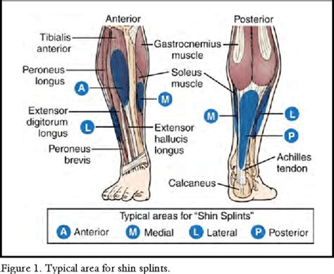 Figure 2 From Medial Tibial Stress Syndrome Semantic Scholar