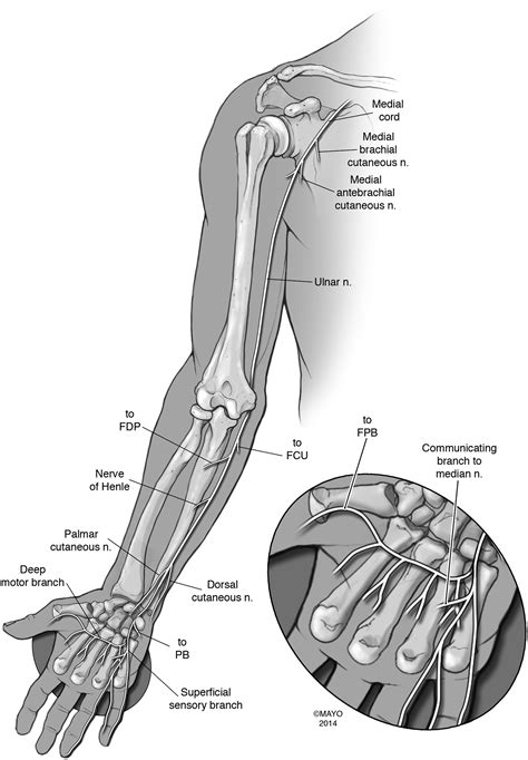 Management Of Ulnar Nerve Injuries Journal Of Hand Surgery