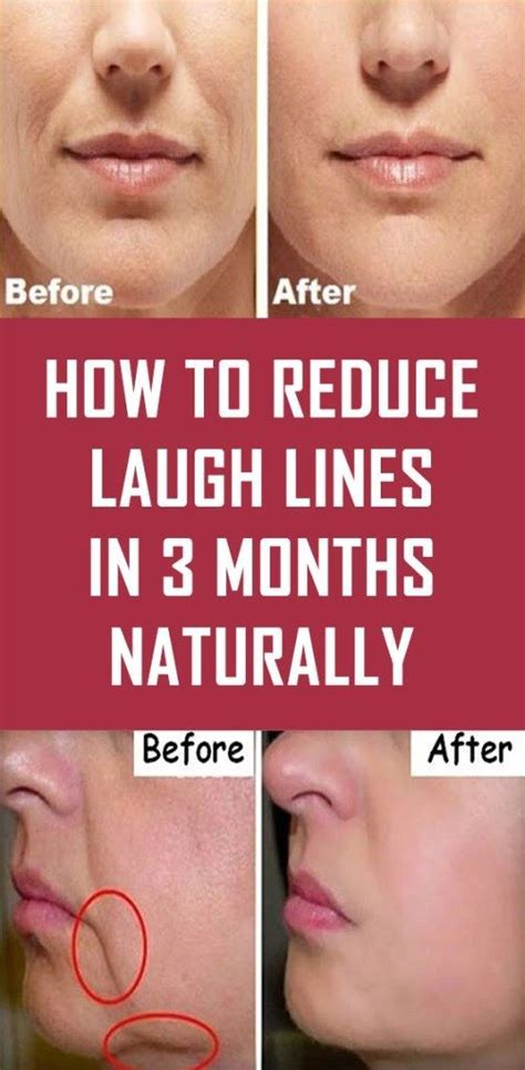 Revitalize & rejuvenate your skin while helping to reduce the visible signs of aging. Easy Skin Care Tips You Should Follow | Laugh lines ...
