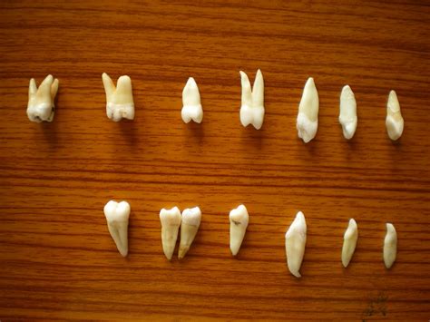 Tafsir dari mimpi gigi patah memiliki banyak sekali tafsiran dan arti gigi geraham patah setengah sudah dibahas oleh nenek moyang masyarakat jawa sejak jaman dahulu. Aisyah's Journey: owh gigiku. jangan kau pergi........