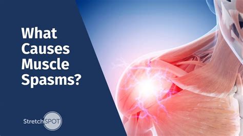 What Causes Muscle Spasms Stretchspot