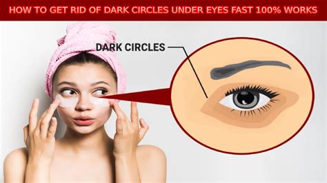 How To Get Rid Of Dark Circles Under Your Eyes Youtube