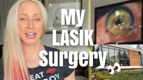 My Lasik Surgery Experience Youtube