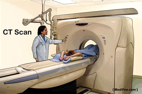 Things You Should Know About Ct Scan Procedurecost