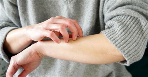 Lymphoma Rash Causes Symptoms And Treatment