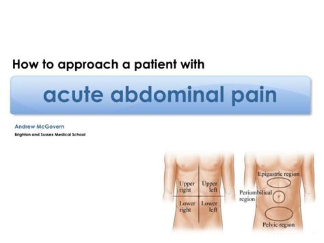 Ppt Acute Abdominal Pain Powerpoint Presentation Free