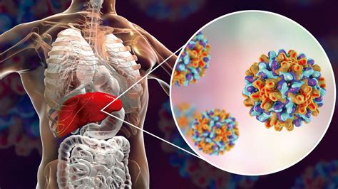 Some people or animals with hepatitis have no symptoms, whereas others develop yellow discoloration of the skin and whites of the eyes (jaundice). La Hepatitis - Laboratorios Bagó