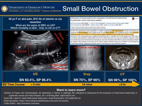 Small Bowel Obstruction Ultrasound Doccheck Hot Sex Picture