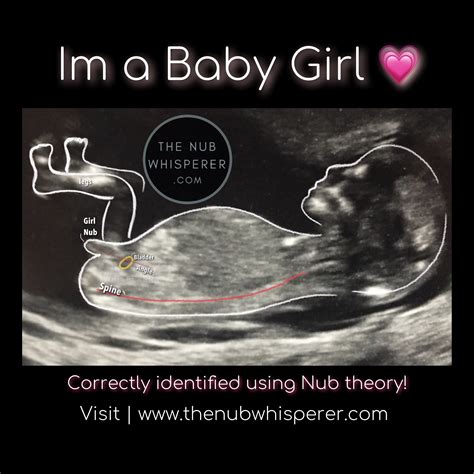 Nub Theory Gender Prediction Boy Ultrasound Pictures Girl Ultrasound