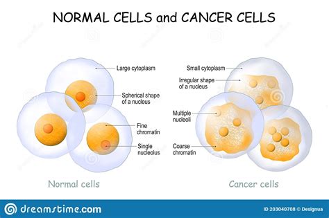 Cancer Cells And Normal Cells Comparison And Difference Stock Vector