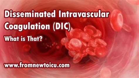 Disseminated Intravascular Coagulation Dicwhat Is That — From New