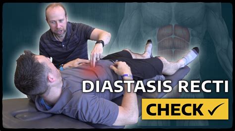 Diastasis Recti Check Physical Therapy Assessment Youtube
