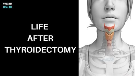 Life After Thyroidectomy Youtube