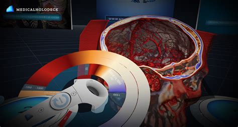 Free virtual mailbox services help you manage your mailroom efficiently. MEDICALHOLODECK PRO FREE TRIAL | FULL FEATURES FOR 30 DAYS ...