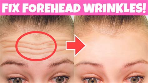 Reduce Forehead Wrinkles In 2 Weeks Forehead Massageand Exercise Get Bigger Eyes Fix Droopy