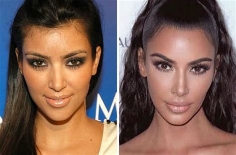 Kim Kardashian Busted Lying About Nose Job The Hollywood Gossip
