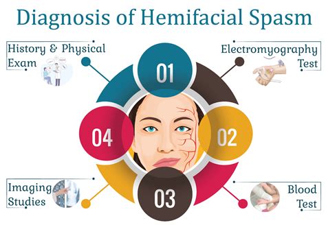 Diagnosis Of Hemifacial Spasm Kayawell