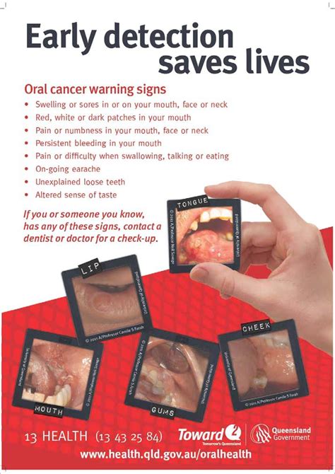 Oral Cancer Early Detection Saves Lives Queensland Health