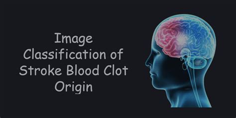 Github Priyansh42stroke Blood Clot Classification This Model