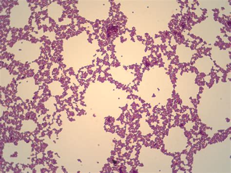 Micro Lab 1 Microbiology 2314 With Ovrebo At University