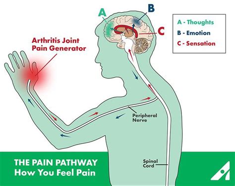The Pain Pathway Medizzy