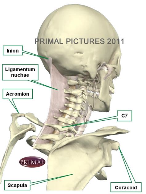 Ligamentum Nuchae Amicus Illustration Of Amicus Injury Cervical Spine