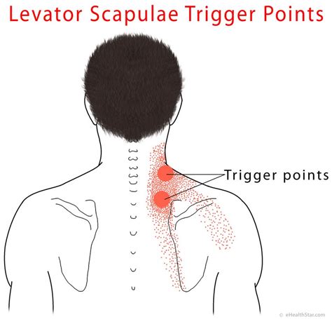 Levator Scapulae Pain Syndrome Trigger Points Stretch EHealthStar