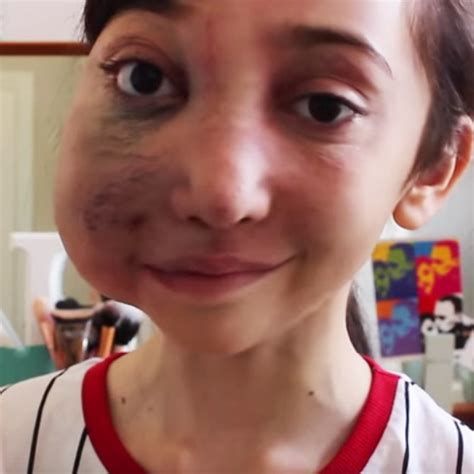 This 11 Year Old With A Rare Condition Is Owning Beauty Blogging