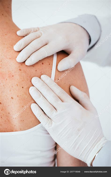 Cropped View Dermatologist Latex Gloves Examining Woman Melanoma Back