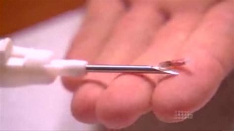 RFID chip in hand